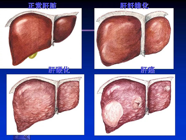 图片-2.jp3g.jpg